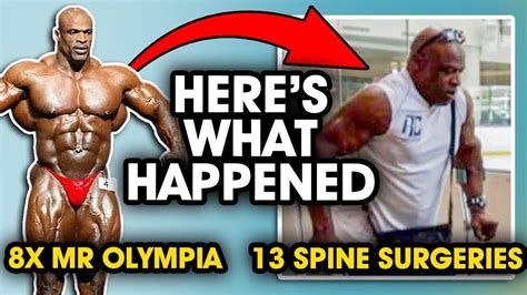 ronnie coleman surgery|what happened to ronnie coleman legs.